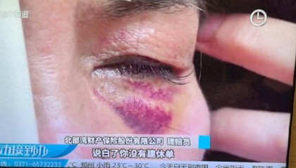 郑州女子摔伤后向饿了么平台索赔 矛盾规定让伤者陷入“理赔困局”